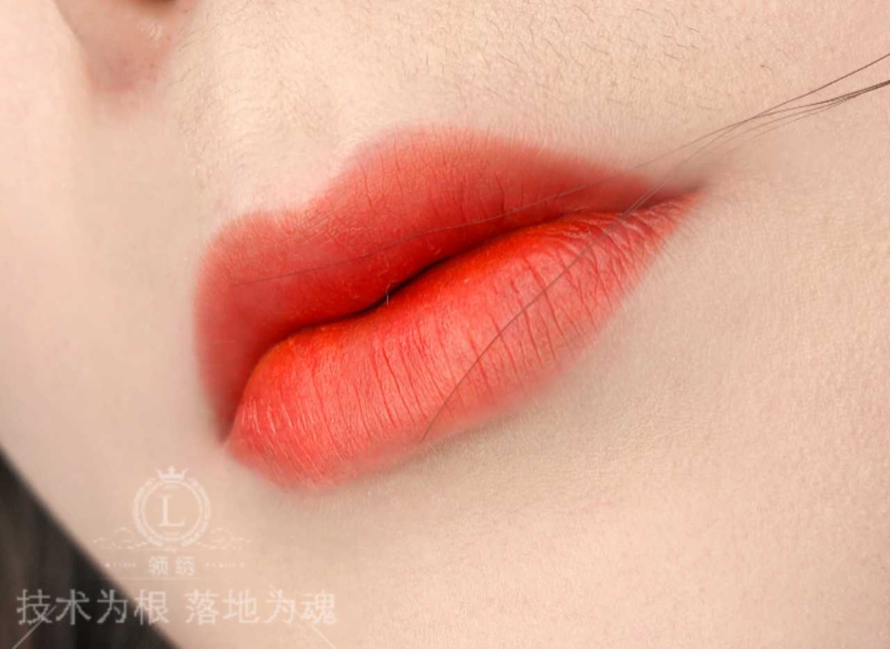 唇部操作后期注意事项